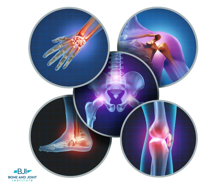 Joint care treatment